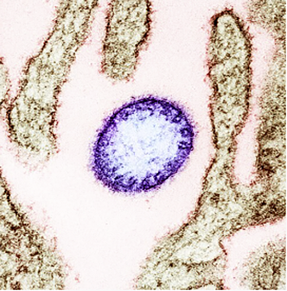 Bahrain sends emergency Nipah antivirals to Kerala